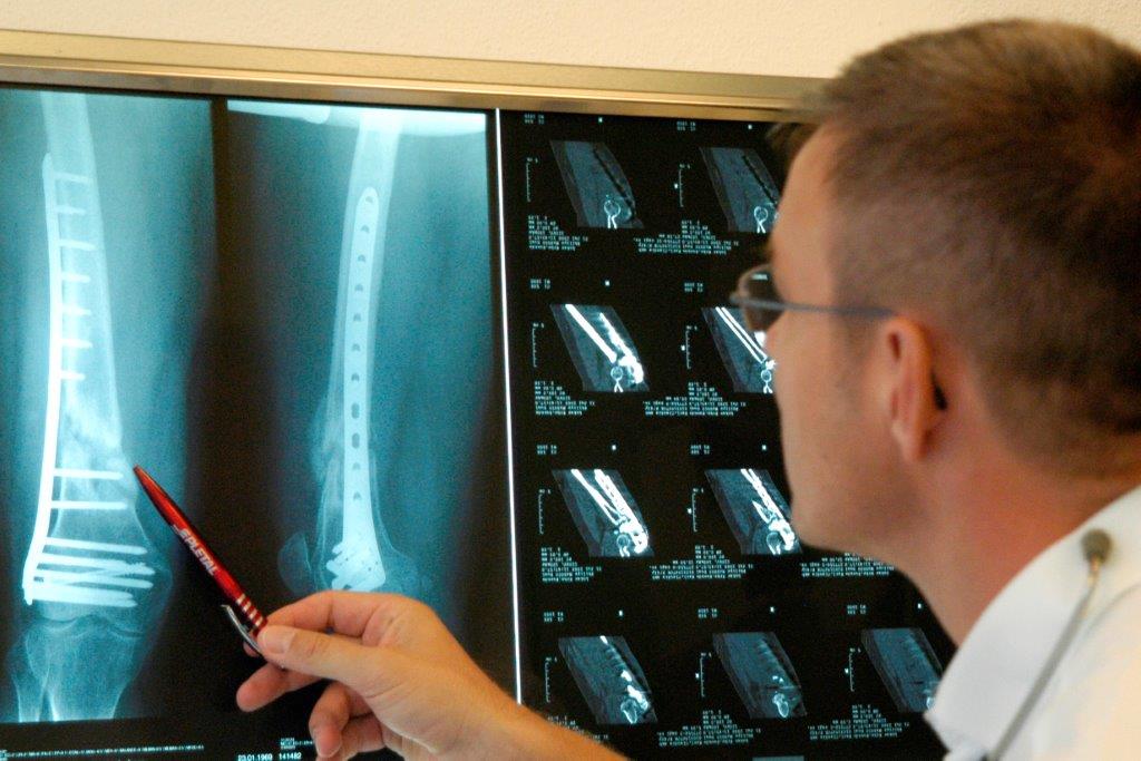 диагностика травм в Германии